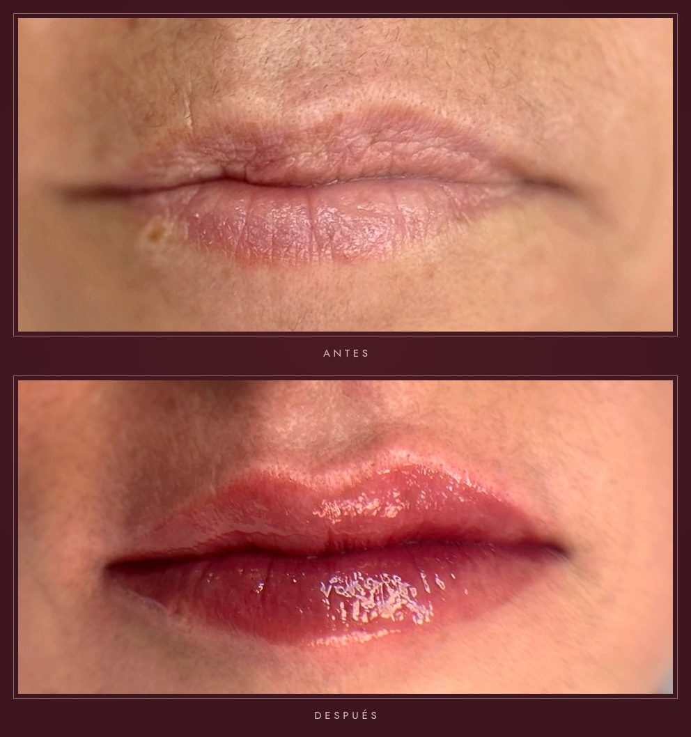 Antes y después de micropigmentación de labios en tono natural en Badalona – Bellagea Studio